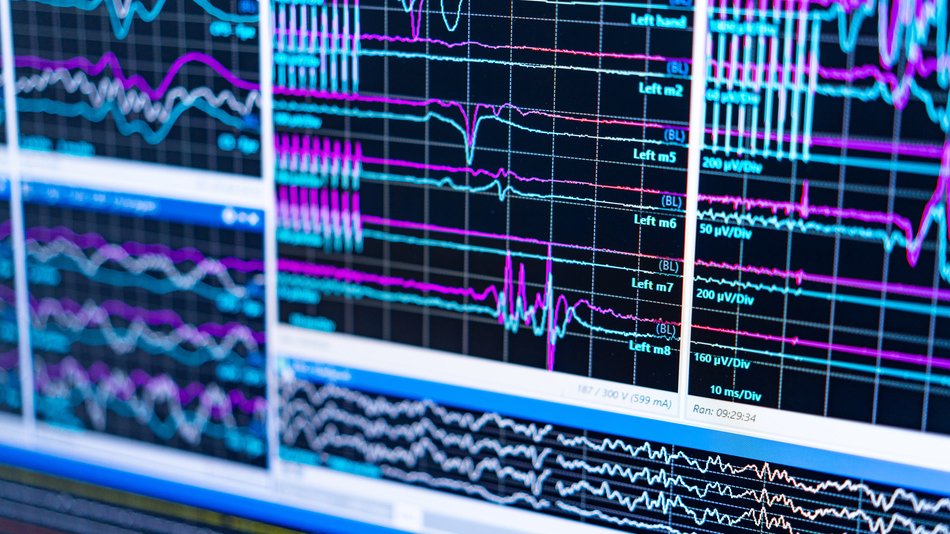 El Neuropsicologo sabe detectar microconductas que sugieran fallos neurol&oacute;gicos