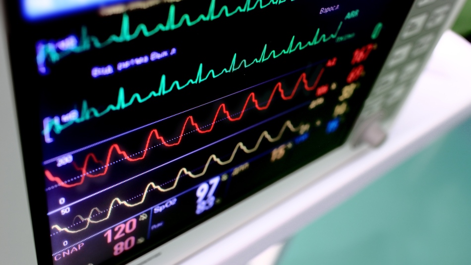 El control de signos vitales requiere un protocolo para evitar falsos diagn&oacute;sticos por sesgos t&eacute;cnicos o emocionales